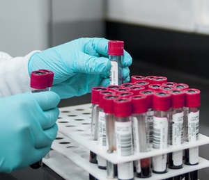 image of blood testing in lab