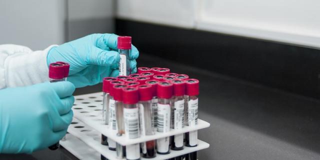 image of blood testing in lab